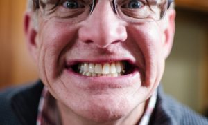 old man showing teeth