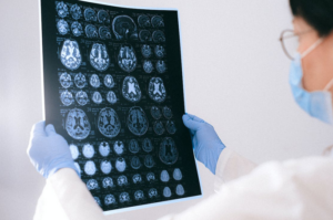 brain